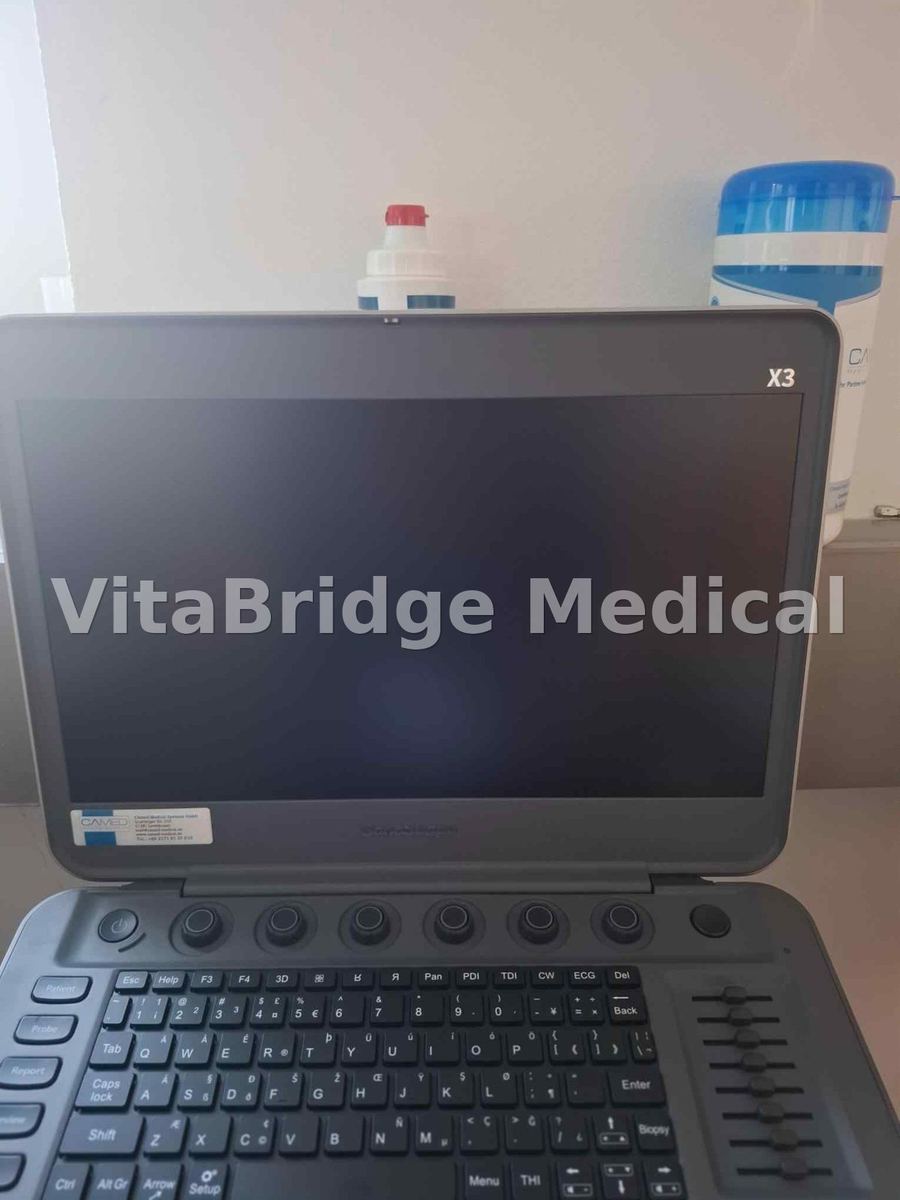 SonoScape X3 portable colour Doppler ultrasound